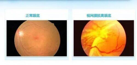 郑州童瞳眼科医院：医生火眼金睛识眼疾 患者感激送鲜花