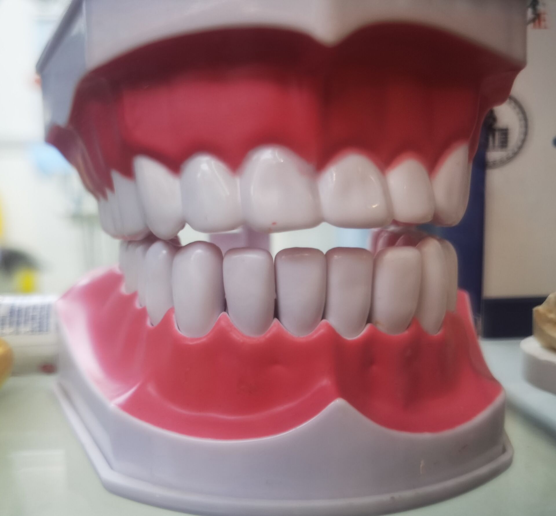  洁牙会让牙缝增大吗？洁牙是怎么一回事？多久时间洁牙一次？